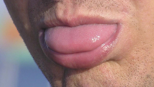 Illustration for article titled Live A Little! Press Your Tongue Against These 10 Pictures Of Tongues